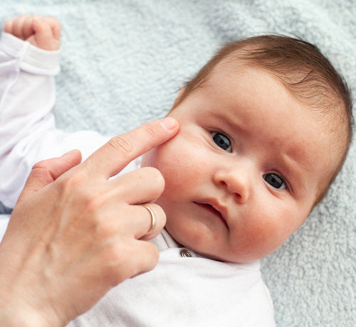 Czy pora roku ma wpływ na przebieg Atopowego Zapalenia Skóry - Mustela Poland - 1