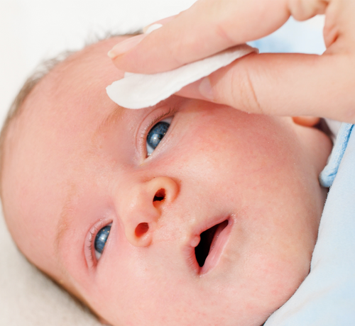 Opuchnięte oczy u dziecka - Mustela Poland - 1