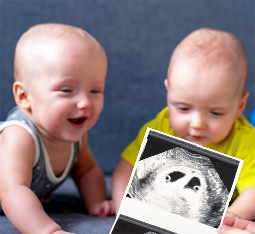 Ciąża bliźniacza co warto o niej wiedzieć - Mustela Poland - 1