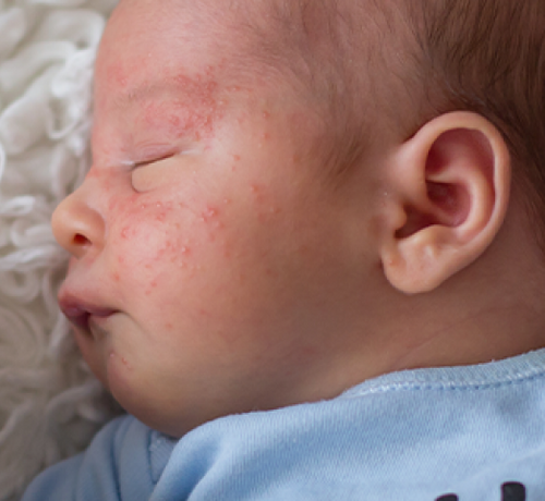 1366x301_0 - Mustela Poland - 1