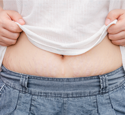 Jak zmienia się funkcja mięśni brzucha w ciąży? - Mustela Poland - 1