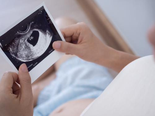 2. miesiąc ciąży: objawy i rozwój tydzień po tygodniu - Mustela Poland - 1