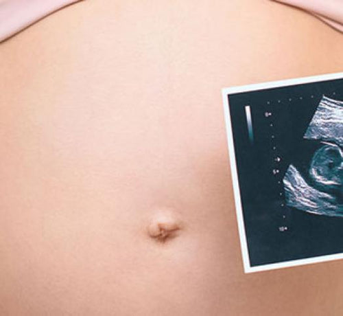 Co-czuje-dziecko-gdy-jest-w-brzuszku-Mamy---1366x301px_111574407_m_0 - Mustela Poland - 1