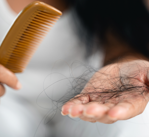 Jak radzić sobie z wypadaniem włosów po porodzie - Mustela Poland - 1