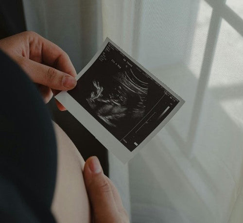 3. miesiąc ciąży: objawy i rozwój, tydzień po tygodniu - Mustela Poland - 1