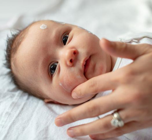 Pieluszkowe zapalenie skóry - jak uniknąć odparzeń pieluszkowych? - Mustela Polska - 1