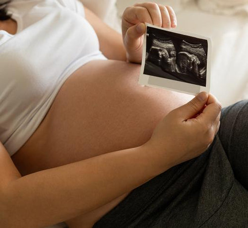 Ból porodowy a znieczulenie - Mustela Poland - 1