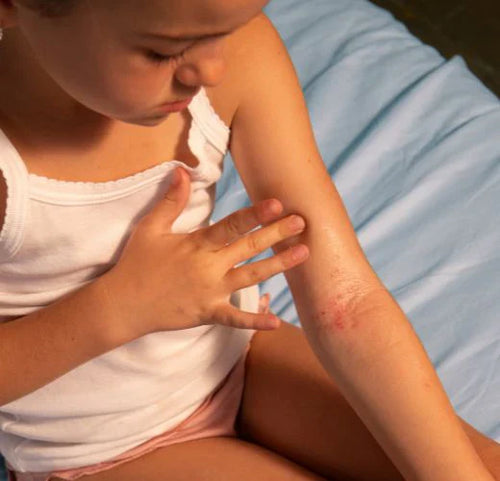 Mustela_soins_bebe_atopie - Mustela Poland - 1